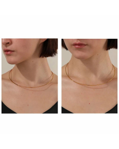 Simple Style Round Choker Stainless Steel Plating Necklace CA07830682